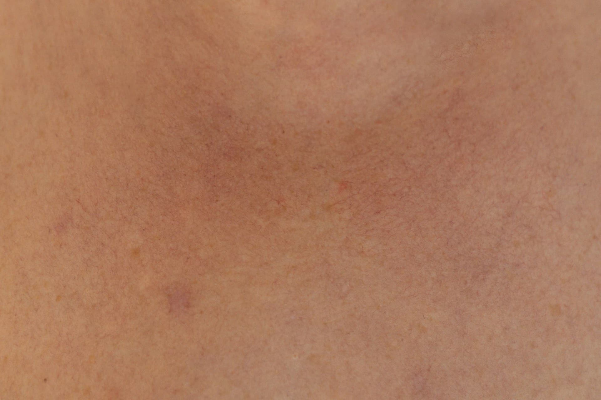 After Image